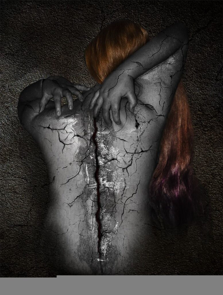 Fracture