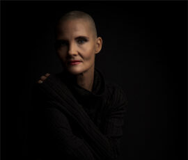 Even Survivors Have Scars Even Survivors Have Scars, Fraser Bryce